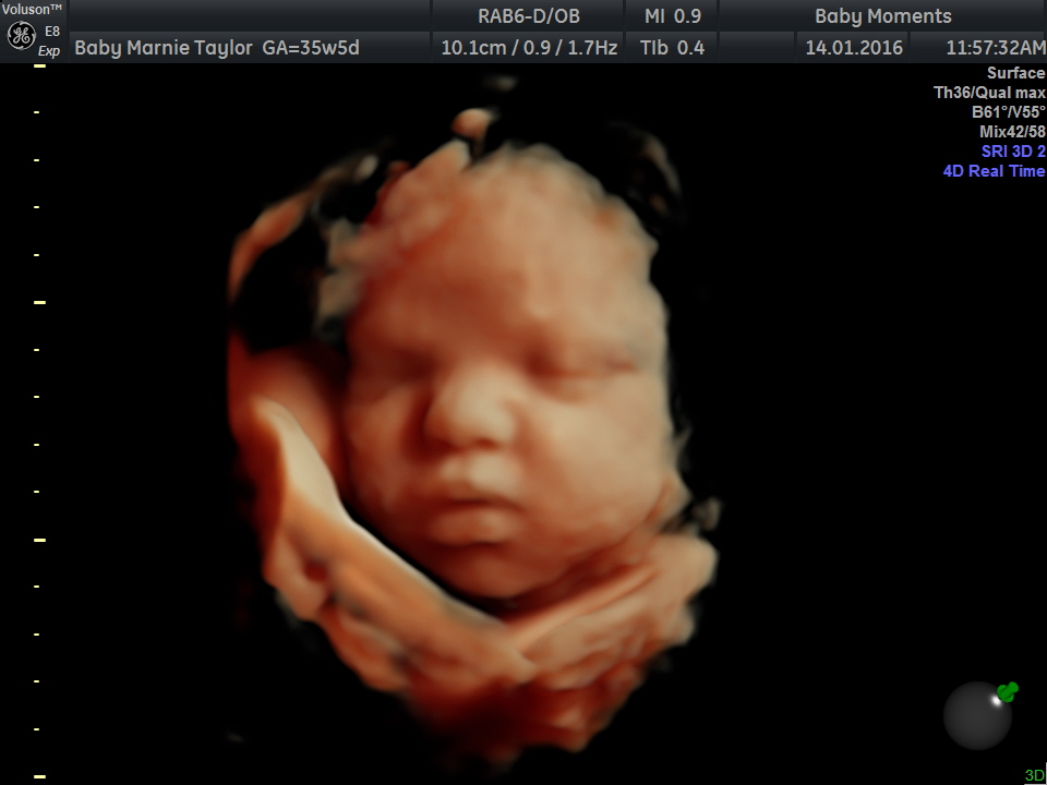 4d ultrasound pictures at 36 weeks