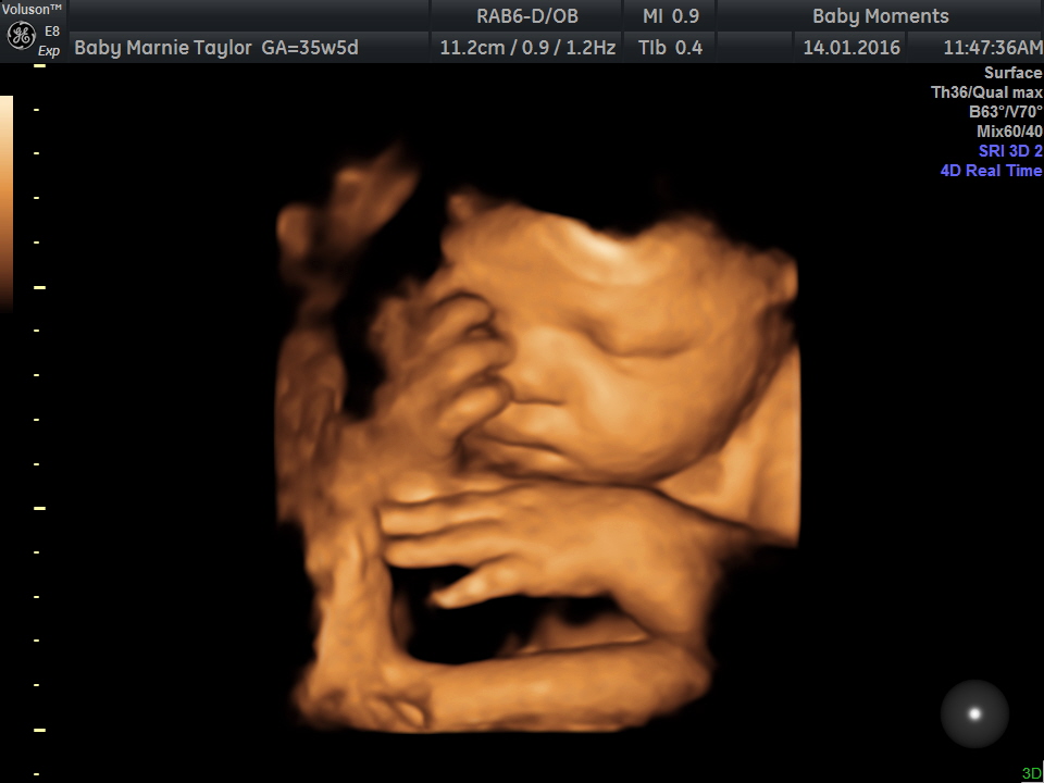 30 weeks pregnant 4d ultrasound